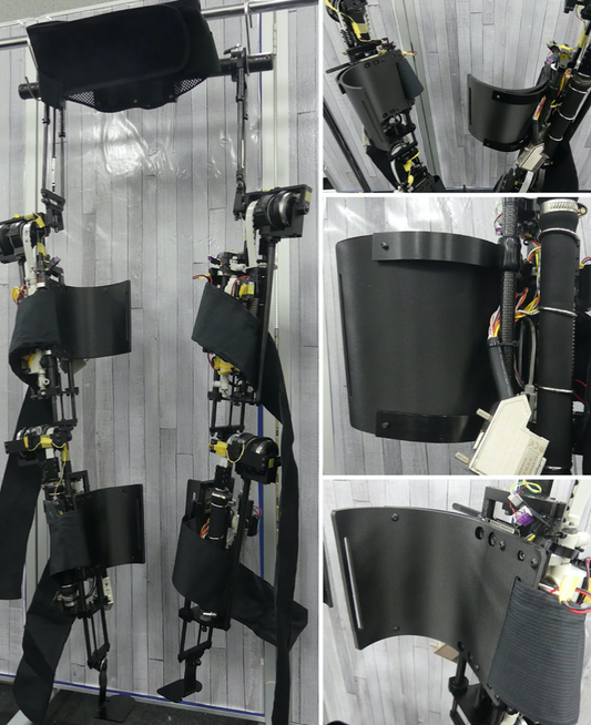 Markforged社3Dプリンターによる下肢支持パーツ開発